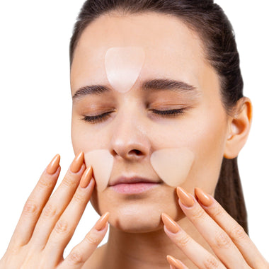 SkinRèmide 160 Triangle Facial Patches - SkinRèmide