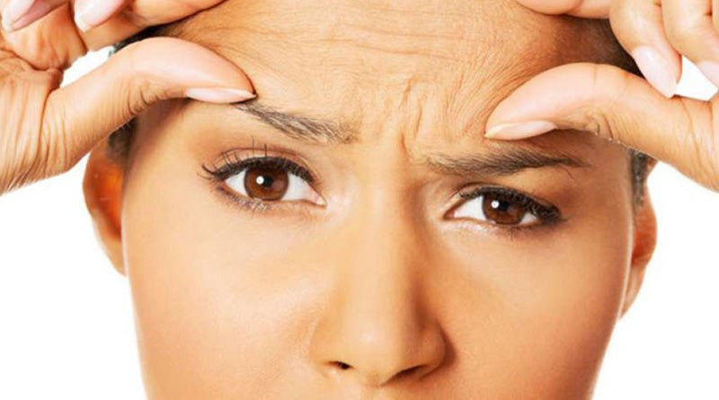 Are Frownies as Good as BOTOX® ? - SkinRèmide