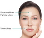 SkinRèmide 160 Triangle Facial Patches - SkinRèmide