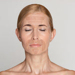 SkinRèmide 165 Variety Facial Patches - SkinRèmide
